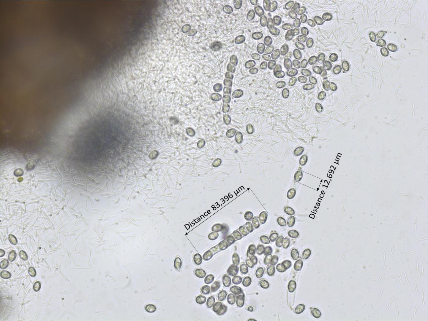 Phyllachora maydis | Iriis