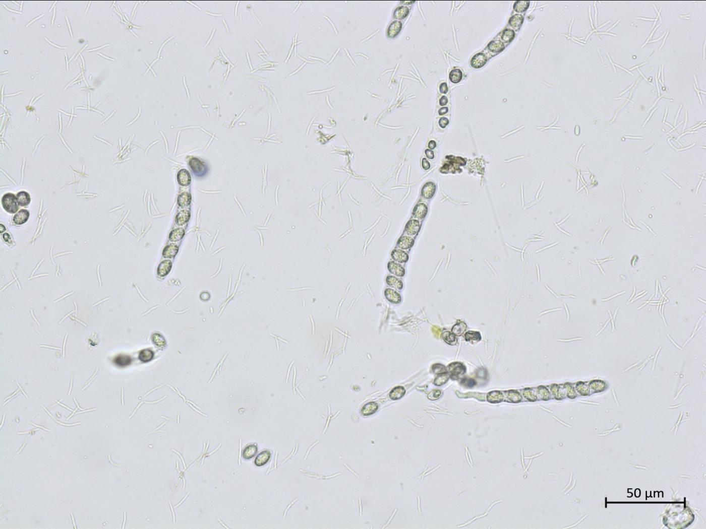 Phyllachora maydis | Iriis