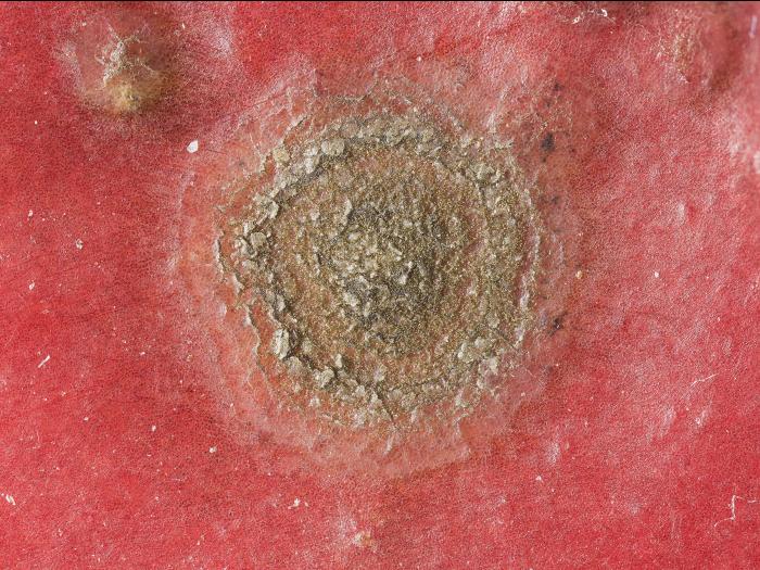 Pomme - Tavelure (Venturia inaequalis)_10