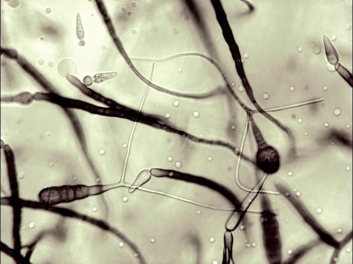 Alternaria_cichorii_4