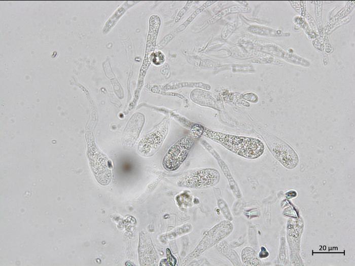 Chaetomium_sp_3
