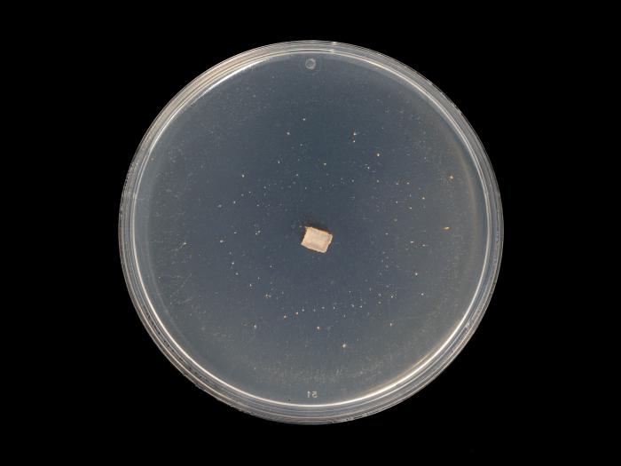 Colletotrichum_siamense_10