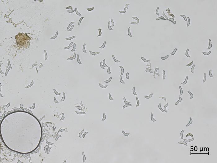 Diplocarpon_fragariae_6