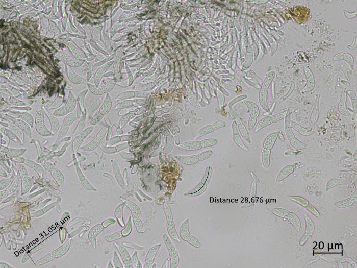 Diplocarpon_fragariae_7