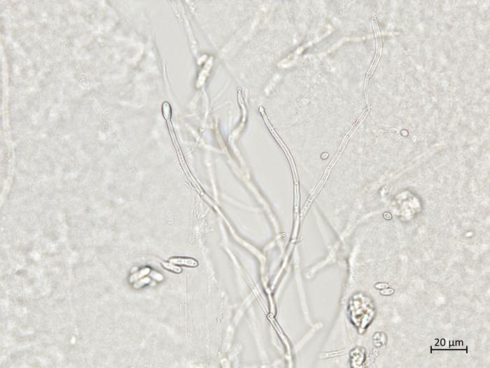 Ilyonectria_liriodendri_2