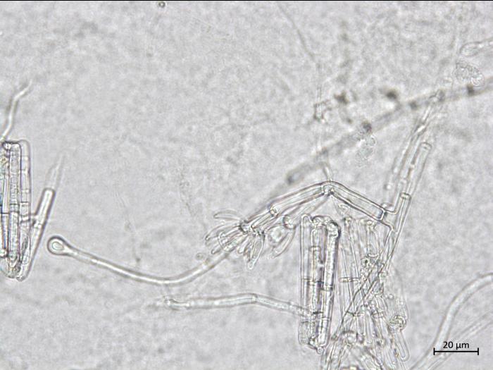 Calonectria_sp_2