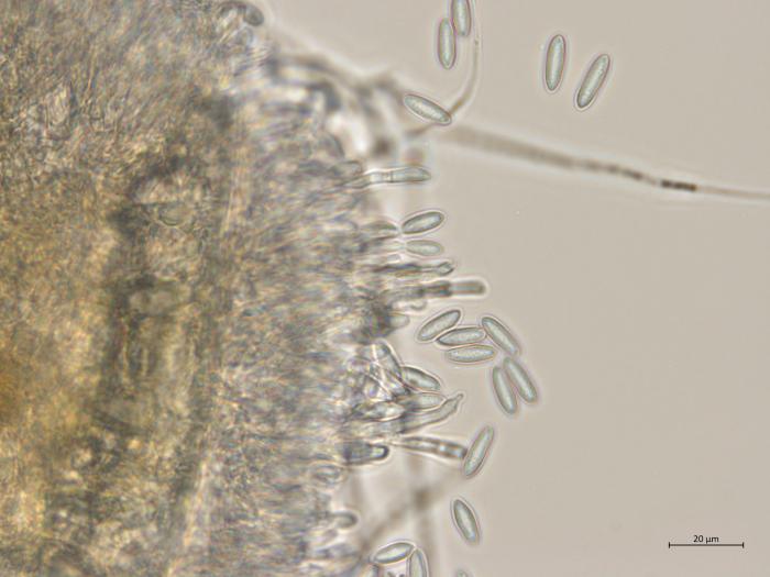 Colletotrichum_sp_4