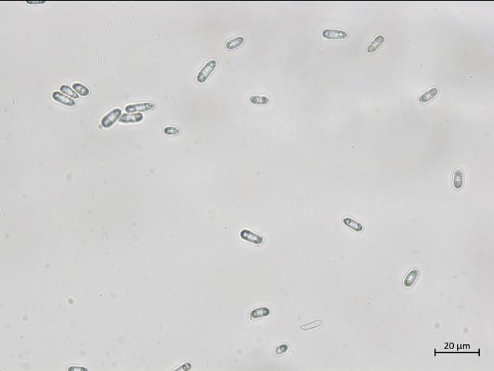 Diaporthe_sp_3