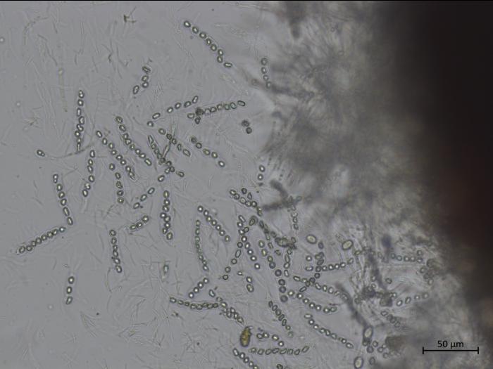 Phyllachora maydis | Iriis