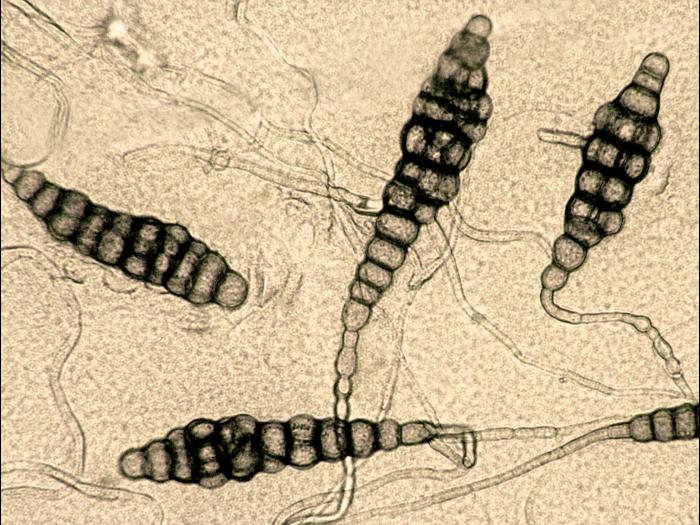 Alternaria_brassicae_4