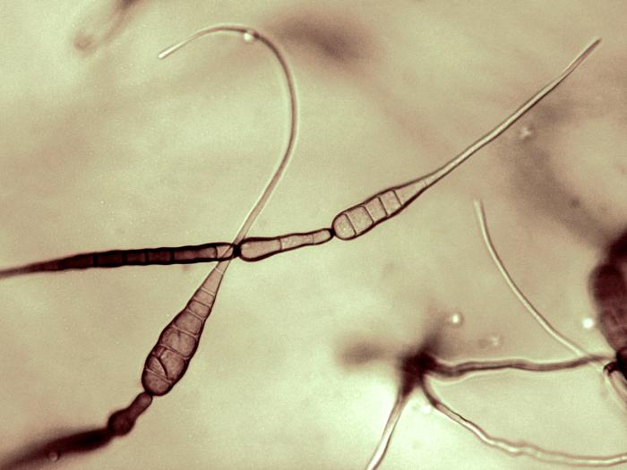 Alternaria_cichorii_2