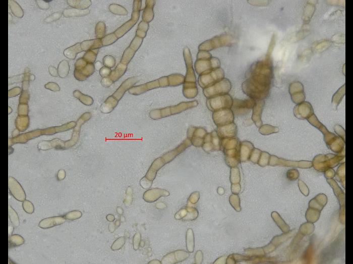 Alternaria_cucumerina_D52977-3_LQ.jpg
