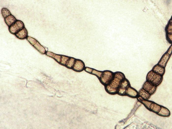 Alternaria_raphani_2