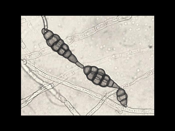 Alternaria_raphani_3