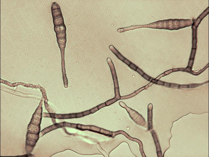 Alternaria_tagetica_2