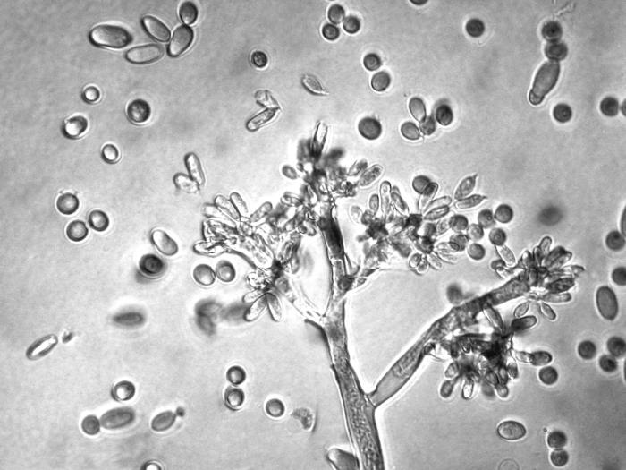 Botrytis_allii-05_LQ