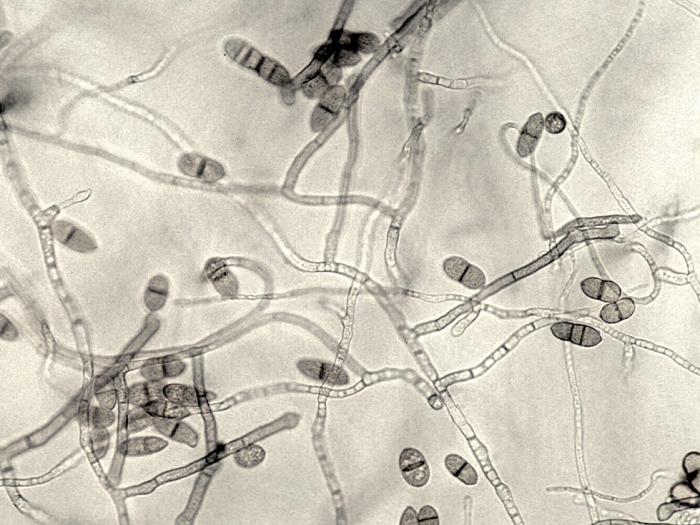 Cladosporium_phlei-01