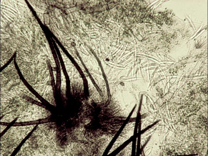 Colletotrichum_truncatum_1