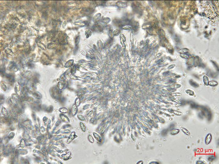 Coniella_diplodiella_1