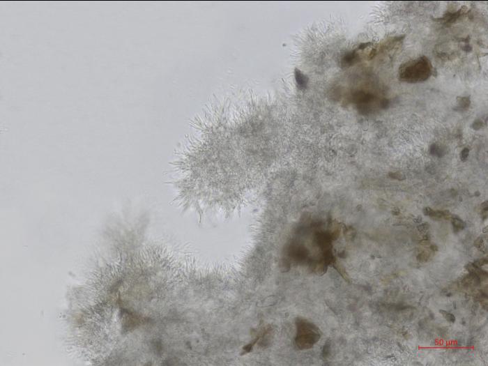 Cytospora_leucostoma_2