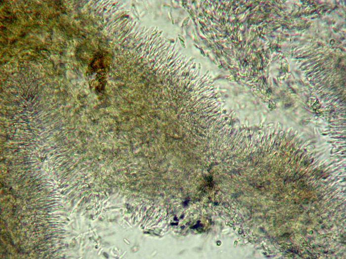 Cytospora_sp_2