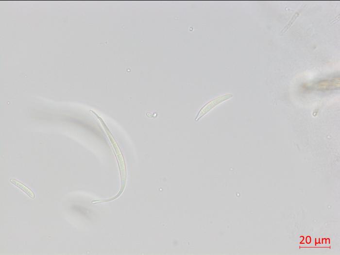 Fusarium_equiseti_2