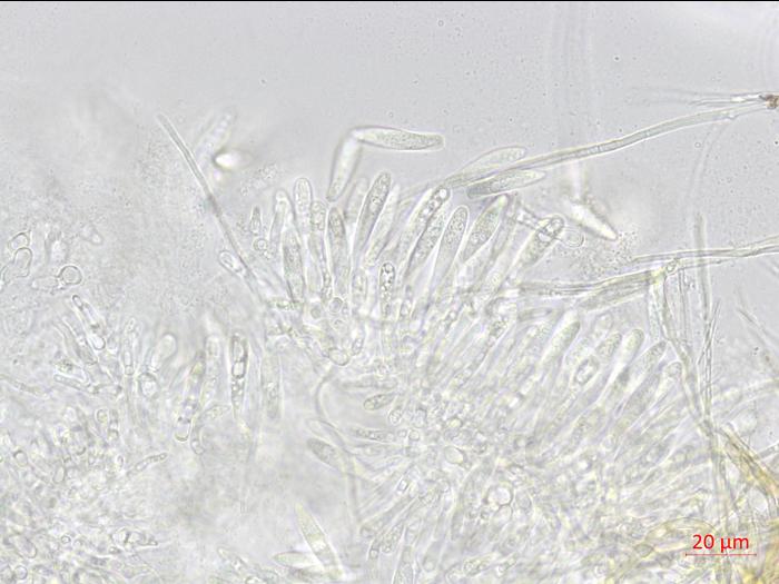 Fusicoccum_aesculi_1