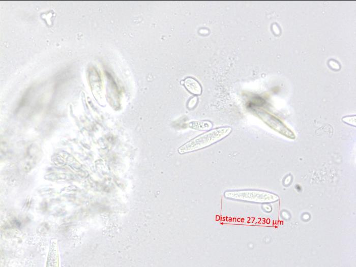 Fusicoccum_aesculi_2