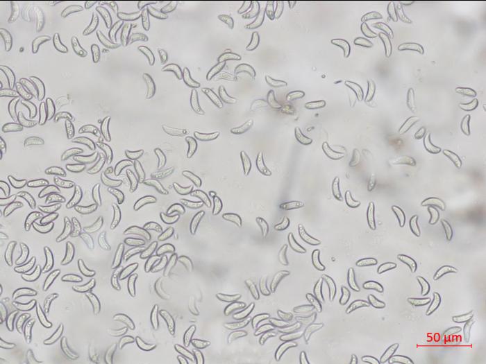 Gloeosporidiella_ribis_2