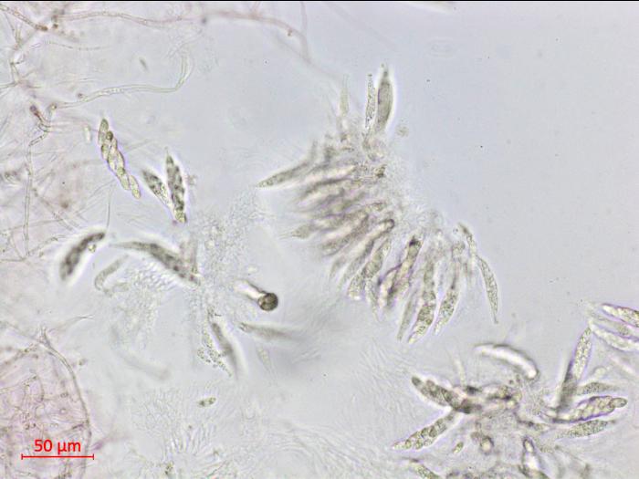 Glomerella_sp_2
