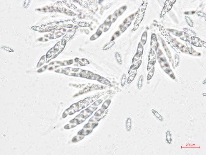 Glomerella_miyabeana_1