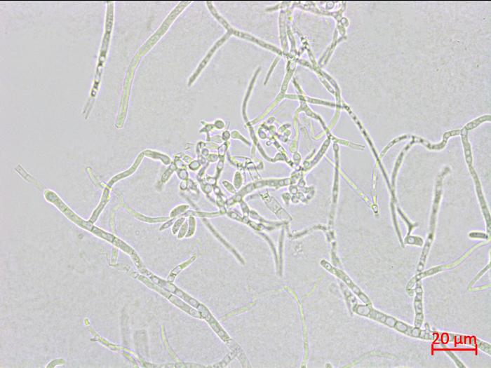 Microdochium_sp_2