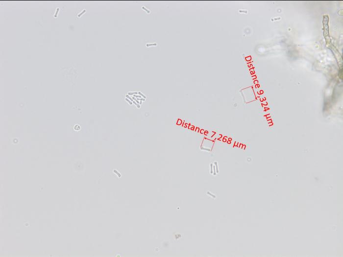 Phyllosticta_ampelicida_4