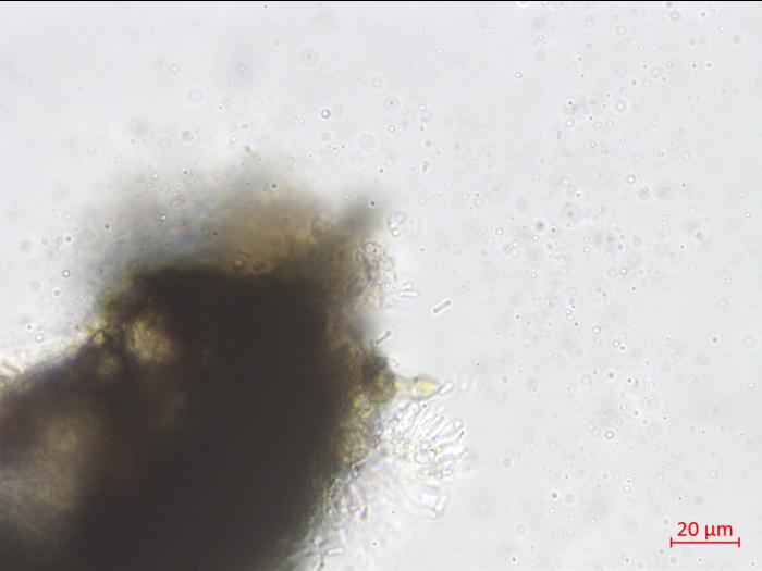 Phyllosticta_ampelicida_5