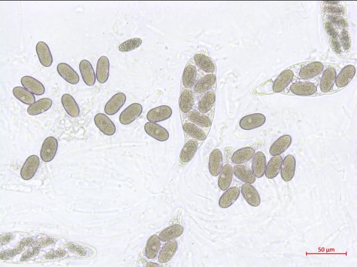 Physalospora_vaccinii_2