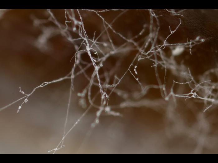 Phytophthora_infestans_1