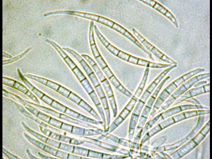 Fusarium_acuminatum_2