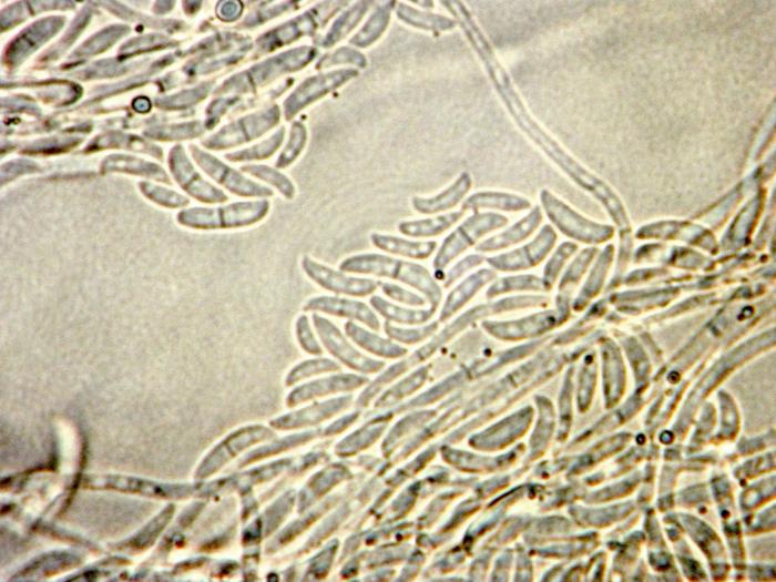 Bisifusarium_dimerum_1