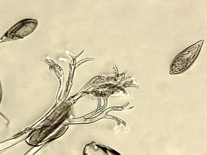 Peronospora_destructor_3