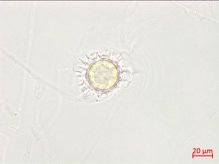 Pythium_uncinulatum_3