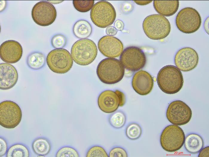 Tilletia_maclaganii_3