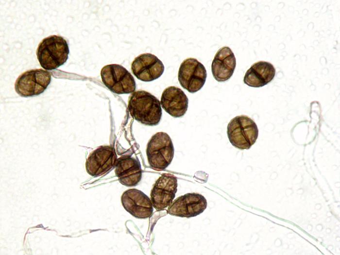 Ulocladium_sp_6