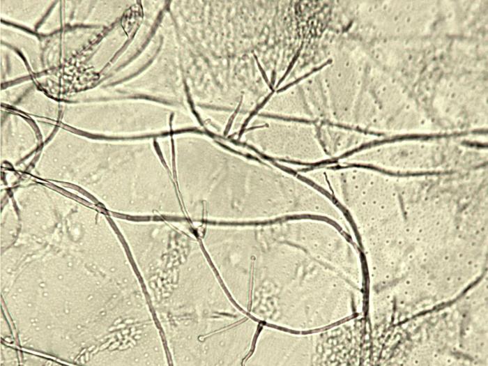 Verticillium_dahliae_1