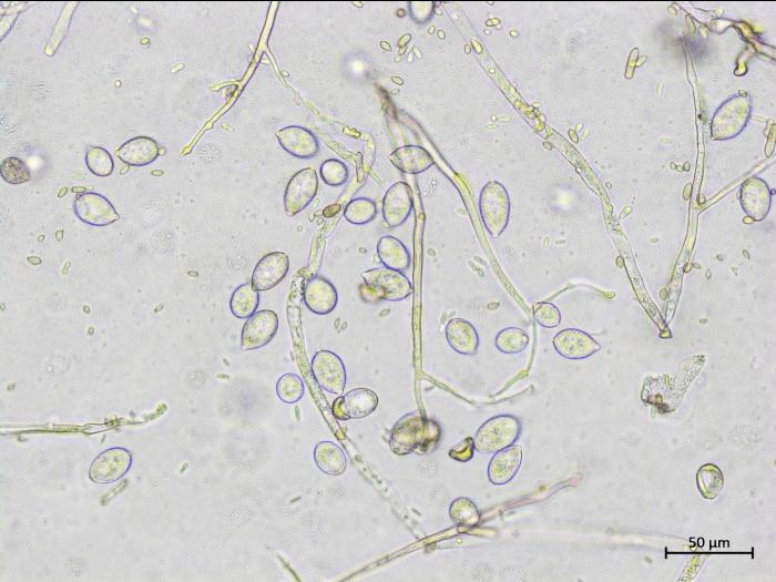 Phytophthora_infestans_5