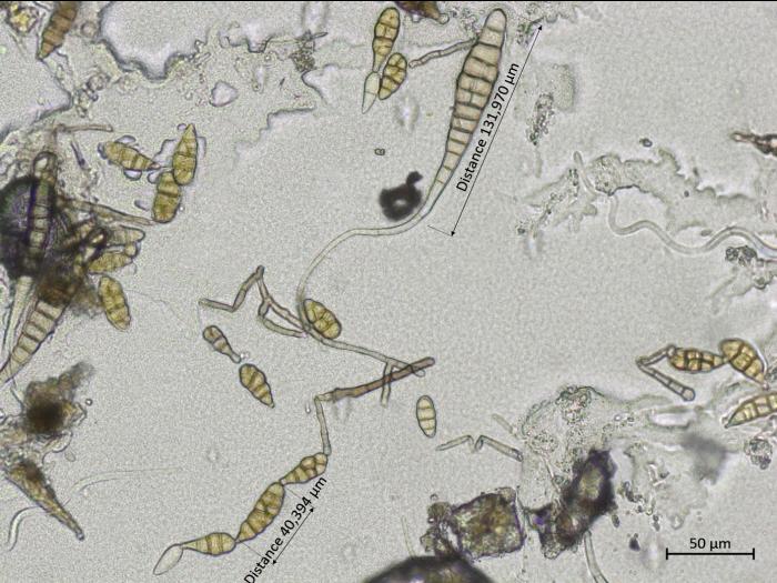 Alternaria_sp_2