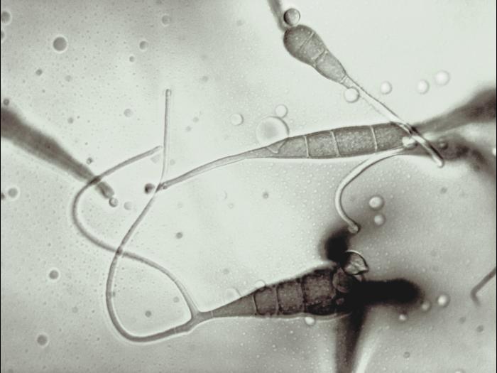 Alternaria_cichorii_6