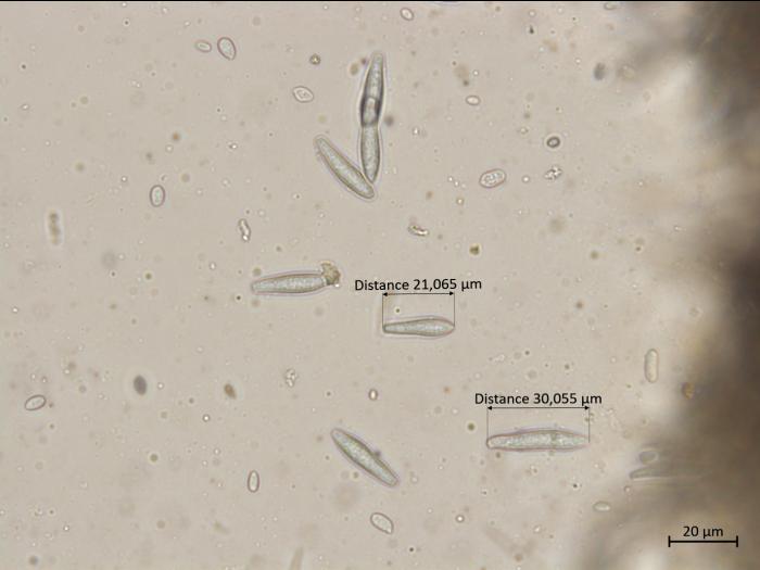 Botryosphaeria_dothidea_3