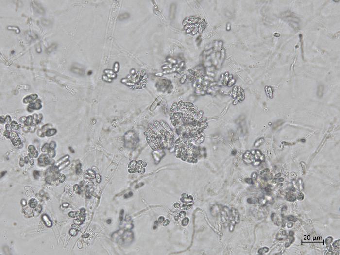 Colletotrichum_coccodes_8