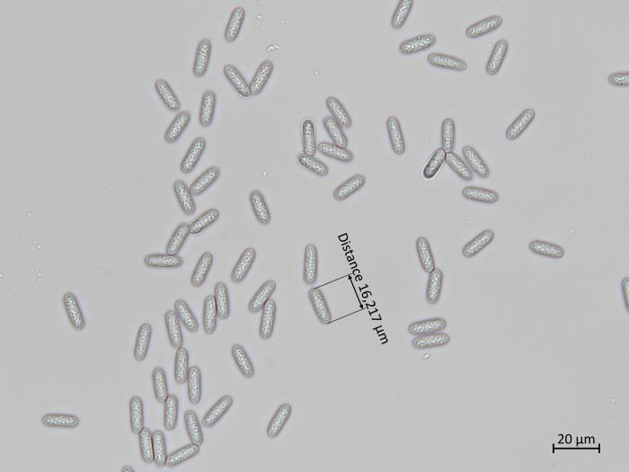 Colletotrichum_siamense_1