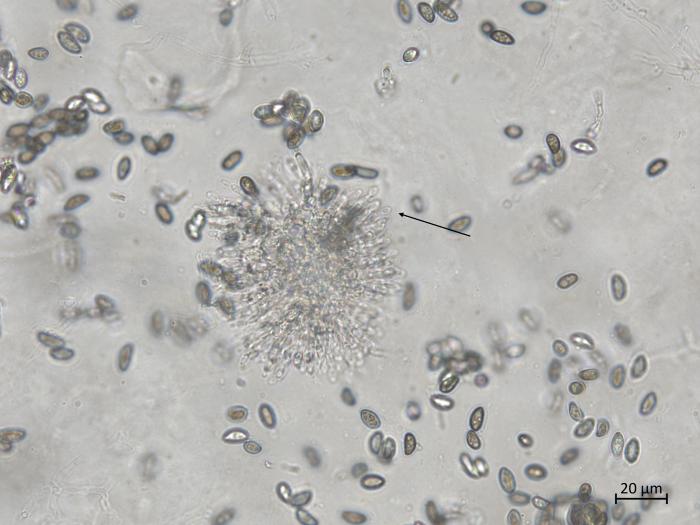 Coniella_diplodiella_4